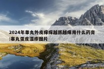 2024年睾丸外皮痒痒越抓越痒用什么药膏:睾丸蛋皮湿疹图片