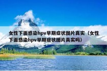 女性下面感染hpv早期症状图片真实（女性下面感染hpv早期症状图片真实吗）